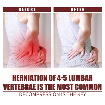 South Moon Lumbar Spine Gold Gel Spray