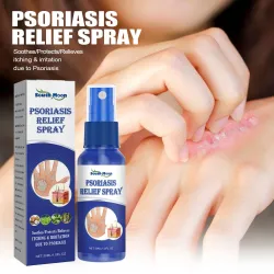 South Moon Psoriasis Relief Spray
