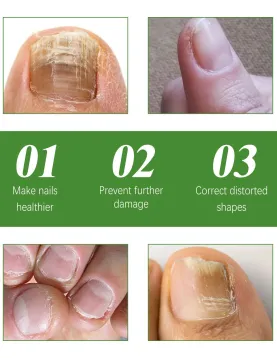 South Moon Health Toenail Stick