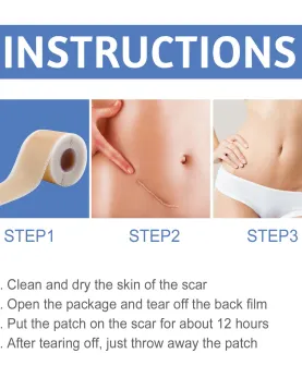 South Moon Silicone Scar Sheets