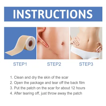 South Moon Silicone Scar Sheets