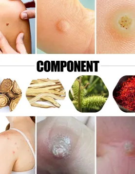 South Moon Corn Removal Plaster