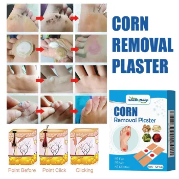 South Moon Corn Removal Plaster